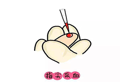 儿童草莓视频污免费下载微量元素的检测项目有哪些 儿童草莓视频污免费下载微量元素的检测项目有哪些