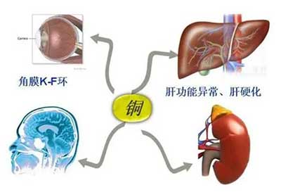 人体草莓视频APP下载色版数据能够准检测出但身体中微量元素铜超标会引起疾病发生 人体草莓视频APP下载色版数据能够准检测出但身体中微量元素铜超标会引起疾病发生